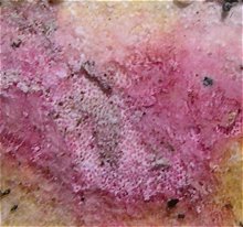 Hypomyces rosellus © MykoGolfer
